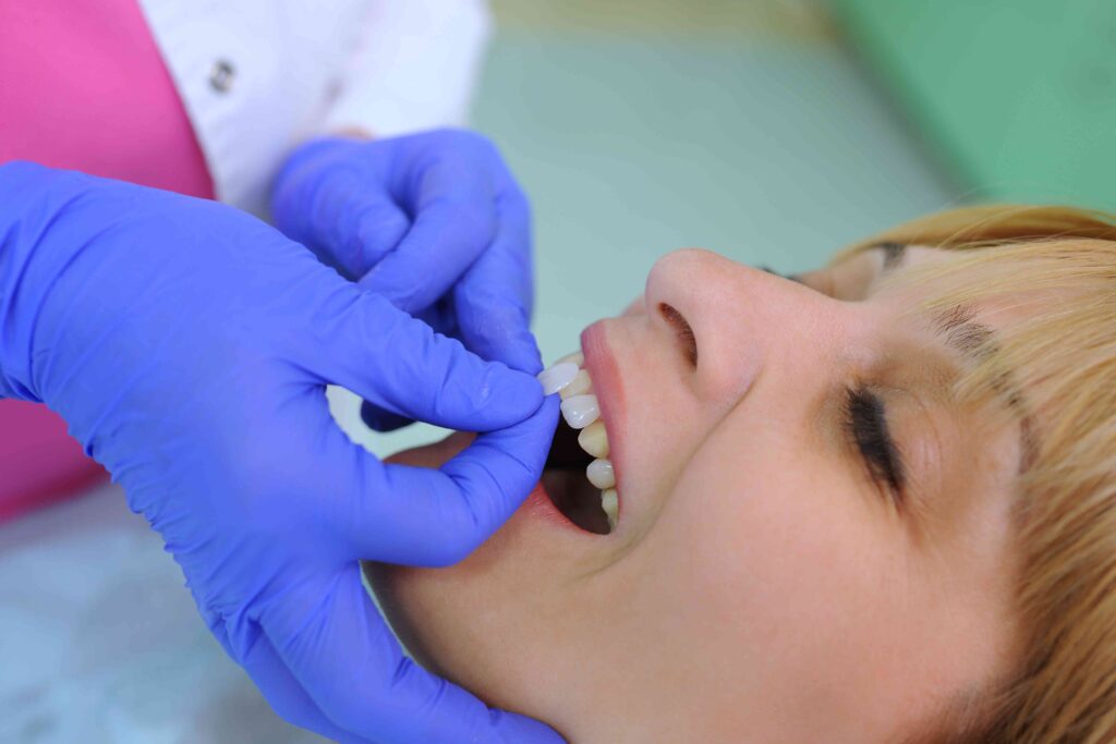 Woman whitening her teeth 